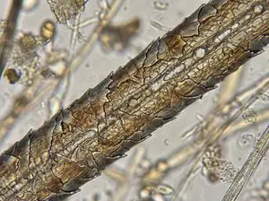 Microscopic View of a Subject